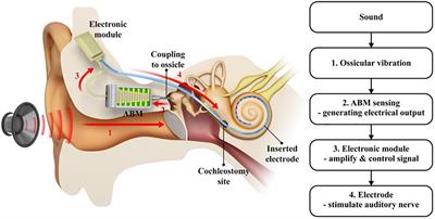 Development and Characterization of a Biomimetic Totally Implantable Artificial <mark class="highlighted">Basilar Membrane</mark> System